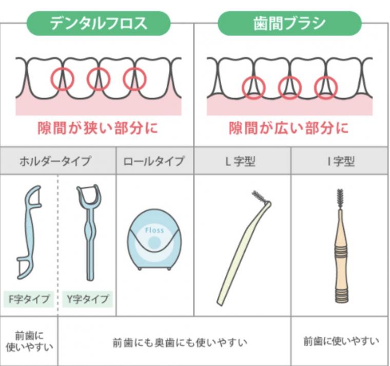 デンタルフロスと歯間ブラシの必要性