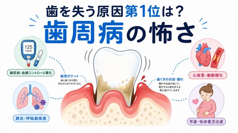 歯を失う原因第1位は？歯周病の怖さ