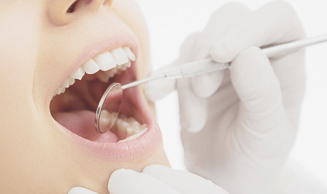 虫歯や歯周病の予防が可能